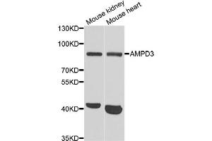 Western blot analysis of extracts of various cell lines, using AMPD3 antibody (ABIN5973764) at 1/1000 dilution. (AMPD3 抗体)