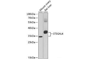Western blot analysis of extracts of various cell lines using ST3GAL4 Polyclonal Antibody at dilution of 1:1000. (ST3GAL4 抗体)