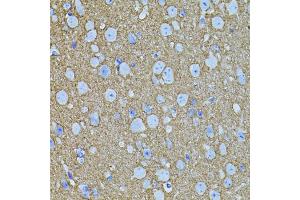 Immunohistochemistry of paraffin-embedded mouse brain using STX1A antibody (ABIN5995405) (40x lens). (STX1A 抗体)