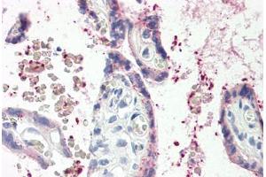 Image no. 1 for anti-Metalloproteinase Inhibitor 2 (TIMP2) (AA 178-193) antibody (ABIN1491040) (TIMP2 抗体  (AA 178-193))