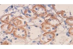 IHC staining of formalin-fixed paraffin-embedded rat kidney with VEGF protein staining, using VEGF antibody (1/100 dilution). (VEGF 抗体  (N-Term))