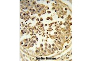Formalin-fixed and paraffin-embedded human testis tissue reacted with DIH2 Antibody (Center), which was peroxidase-conjugated to the secondary antibody, followed by DAB staining. (DIAPH2 抗体  (AA 870-899))