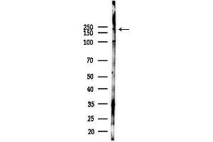 Western blot analysis of lysates from Hela cells(heat-shock 45 min treatment), using MYH15 Antibody at 1/1000 dilution.