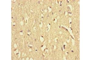 Immunohistochemistry of paraffin-embedded human brain tissue using ABIN7175867 at dilution of 1:100 (WAC 抗体  (AA 10-102))
