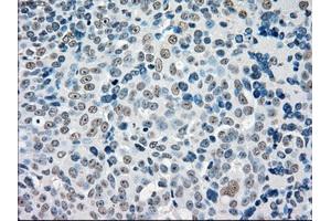 Immunohistochemical staining of paraffin-embedded colon tissue using anti-STK3mouse monoclonal antibody. (STK3 抗体)