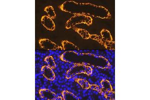 Immunofluorescence analysis of rat kidney using PDZK1 Rabbit mAb (ABIN7269199) at dilution of 1:100 (40x lens). (PDZK1 抗体)