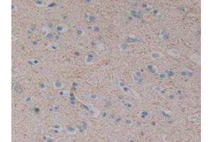 Immunohistochemistry (IHC) image for anti-Substance P antibody (ABIN7445417)