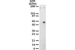 Image no. 1 for anti-Activating Transcription Factor 2 (ATF2) (pThr71) antibody (ABIN208166) (ATF2 抗体  (pThr71))