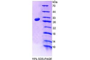 SDS-PAGE (SDS) image for Centromere Protein J (CENPJ) (AA 1-207) protein (His tag) (ABIN4989102) (CENPJ Protein (AA 1-207) (His tag))