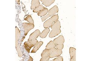 Immunohistochemistry of paraffin-embedded rat skeletal muscle using CLCN1 Rabbit pAb (ABIN6130939, ABIN6138661, ABIN6138662 and ABIN6221409) at dilution of 1:200 (40x lens). (CLCN1 抗体  (AA 779-988))