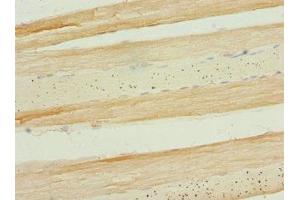 Immunohistochemistry of paraffin-embedded human skeletal muscle tissue using ABIN7159666 at dilution of 1:100 (APIP 抗体  (AA 1-242))