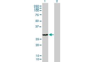 Western Blot analysis of CLEC4A expression in transfected 293T cell line by CLEC4A MaxPab polyclonal antibody. (CLEC4A 抗体  (AA 1-237))