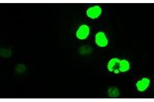 Image no. 18 for anti-Myc Proto-Oncogene protein (MYC) antibody (ABIN1497011) (c-MYC 抗体)