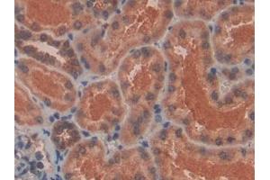 Detection of PLXNB1 in Human Kidney Tissue using Polyclonal Antibody to Plexin B1 (PLXNB1)