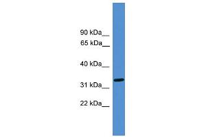 WB Suggested Anti-LUC7L Antibody Titration: 0. (LUC7L 抗体  (Middle Region))