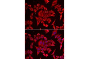 Immunofluorescence (IF) image for anti-Solute Carrier Family 20 (Phosphate Transporter), Member 2 (SLC20A2) (AA 235-485) antibody (ABIN6147880)