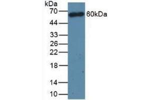 Detection of CD4 in Mouse Thymus Tissue using Polyclonal Antibody to Cluster Of Differentiation 4 (CD4) (CD4 抗体  (AA 27-394))
