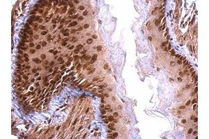 Immunohistochemistry (IHC) image for anti-Scaffold Attachment Factor B (SAFB) antibody (ABIN2855048)