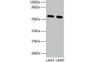 Western blot All lanes: PHGDH antibody at 2 μg/mL Lane 1: EC109 whole cell lysate Lane 2: 293T whole cell lysate Secondary Goat polyclonal to rabbit IgG at 1/15000 dilution Predicted band size: 57 kDa Observed band size: 57 kDa (PHGDH 抗体  (AA 2-251))