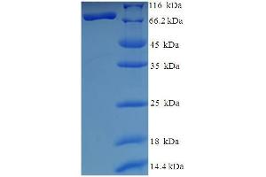 SDS-PAGE (SDS) image for Histone Deacetylase 1 (HDAC1) (AA 1-482), (full length) protein (His-SUMO Tag) (ABIN5709649)