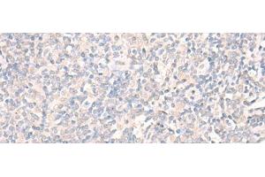 Immunohistochemistry of paraffin-embedded Human tonsil tissue using LILRA2 Polyclonal Antibody at dilution of 1:40(x200)