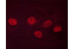 Immunofluorescence (fixed cells) (IF/ICC) image for anti-cAMP Responsive Element Binding Protein 1 (CREB1) (pSer142) antibody (ABIN6254981)