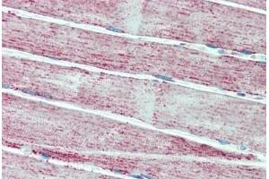 Human Skeletal Muscle: Formalin-Fixed, Paraffin-Embedded (FFPE)
