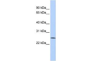 WB Suggested Anti-FBXO22 Antibody Titration: 0.