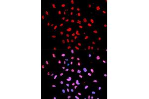 Immunofluorescence analysis of U2OS cells using Phospho-Btk-Y223 antibody (ABIN5969941). (BTK 抗体  (pTyr223))