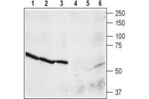 Western blot analysis of rat brain membrane (lanes 1 and 4), cortex (lanes 2 and 5), and hippocampus (lanes 3 and 6) lysates: - 1,2,3. (NPY4R 抗体  (C-Term, Intracellular))