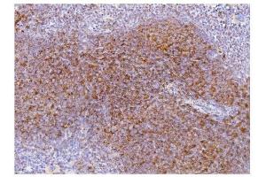 IHC analysis of Cd2 using anti-Cd2 antibody (ABIN7601386).