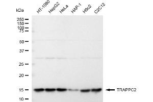 anti-Trafficking Protein Particle Complex 2 (TRAPPC2) antibody