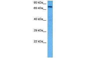 Host:  Rat  Target Name:  KCND3  Sample Tissue:  Rat Liver  Antibody Dilution:  1ug/ml (KCND3 抗体  (Middle Region))
