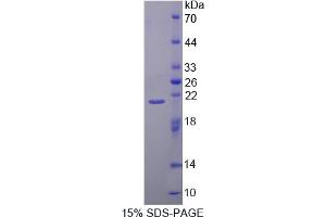 SDS-PAGE analysis of Mouse CAPN1 Protein. (CAPNL1 蛋白)