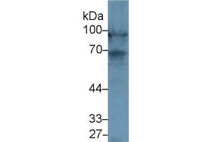 Western Blot; Sample: Rat Heart lysate; Primary Ab: 1µg/ml Rabbit Anti-Rat NEXN Antibody Second Ab: 0. (NEXN 抗体  (AA 214-455))