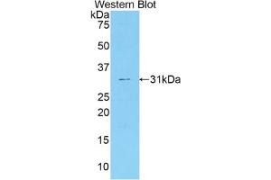 Western blot analysis of the recombinant protein. (Coagulation Factor V 抗体  (AA 364-611))