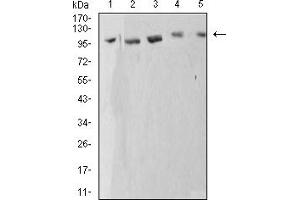 Western Blotting (WB) image for anti-ATPase, Ca++ Transporting, Cardiac Muscle, Fast Twitch 1 (ATP2A1) (AA 487-631) antibody (ABIN5611123)