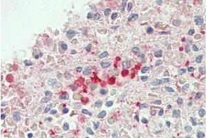 ABIN1782177 (5µg/ml) staining of paraffin embedded Human Spleen. (BLVRB 抗体  (AA 38-49))