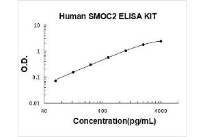 Typical Standard Curve