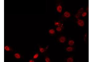 ABIN6266874 staining HeLa by IF/ICC. (ZNF337 抗体)