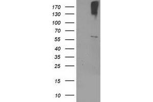 Western Blotting (WB) image for anti-Cytochrome P450, Family 2, Subfamily J, Polypeptide 2 (CYP2J2) antibody (ABIN1497732) (CYP2J2 抗体)