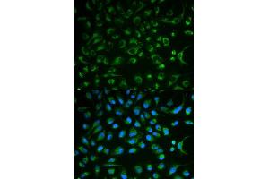 Immunofluorescence analysis of MCF7 cell using NT5E antibody. (CD73 抗体  (AA 290-550))