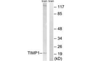 Western blot analysis of extracts from rat brain cells, using TIMP1 Antibody. (TIMP1 抗体  (AA 61-110))