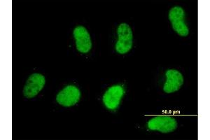 Immunofluorescence of monoclonal antibody to SMARCD2 on HeLa cell. (SMARCD2 抗体  (AA 398-474))