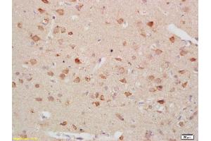 Formalin-fixed and paraffin embedded rat brain labeled with Anti-Gastrin receptor Polyclonal Antibody, Unconjugated (ABIN734318) at 1:200 followed by conjugation to the secondary antibody and DAB staining (CCKBR 抗体  (AA 301-400))