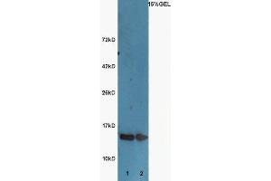 Lane 1:Huh7 lysates Lane 2: A549 lysates probed with Rabbit  Anti-Histone H3 (acetyl K9) Polyclonal Antibody, Unconjugated (ABIN703946) at 1:300 overnight at 4 °C. (Histone 3 抗体  (H3K9ac))