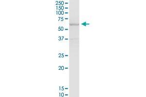 Western Blotting (WB) image for anti-Solute Carrier Family 7 (Cationic Amino Acid Transporter, Y+ System), Member 1 (SLC7A1) (AA 1-629) antibody (ABIN520252)