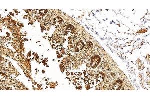 IHC analysis of TPH1 using anti-TPH1 antibody (ABIN7601556).