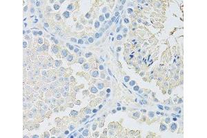 Immunohistochemistry (Paraffin-embedded Sections) (IHC (p)) image for anti-Solute Carrier Family 2 (Facilitated Glucose Transporter), Member 9 (SLC2A9) antibody (ABIN7257984)