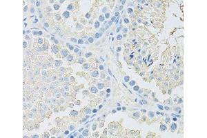 Immunohistochemistry of paraffin-embedded Mouse testis using SLC2A9 Polyclonal Antibody at dilution of 1:100 (40x lens). (SLC2A9 抗体)